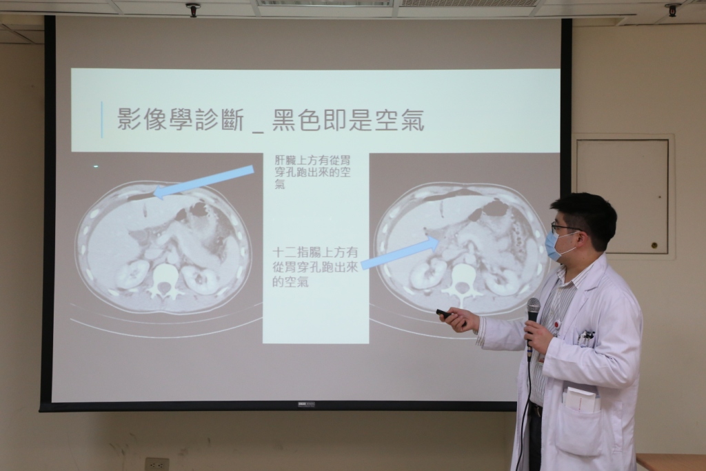 麻豆新樓醫院「腹部急症微創手術」首例 