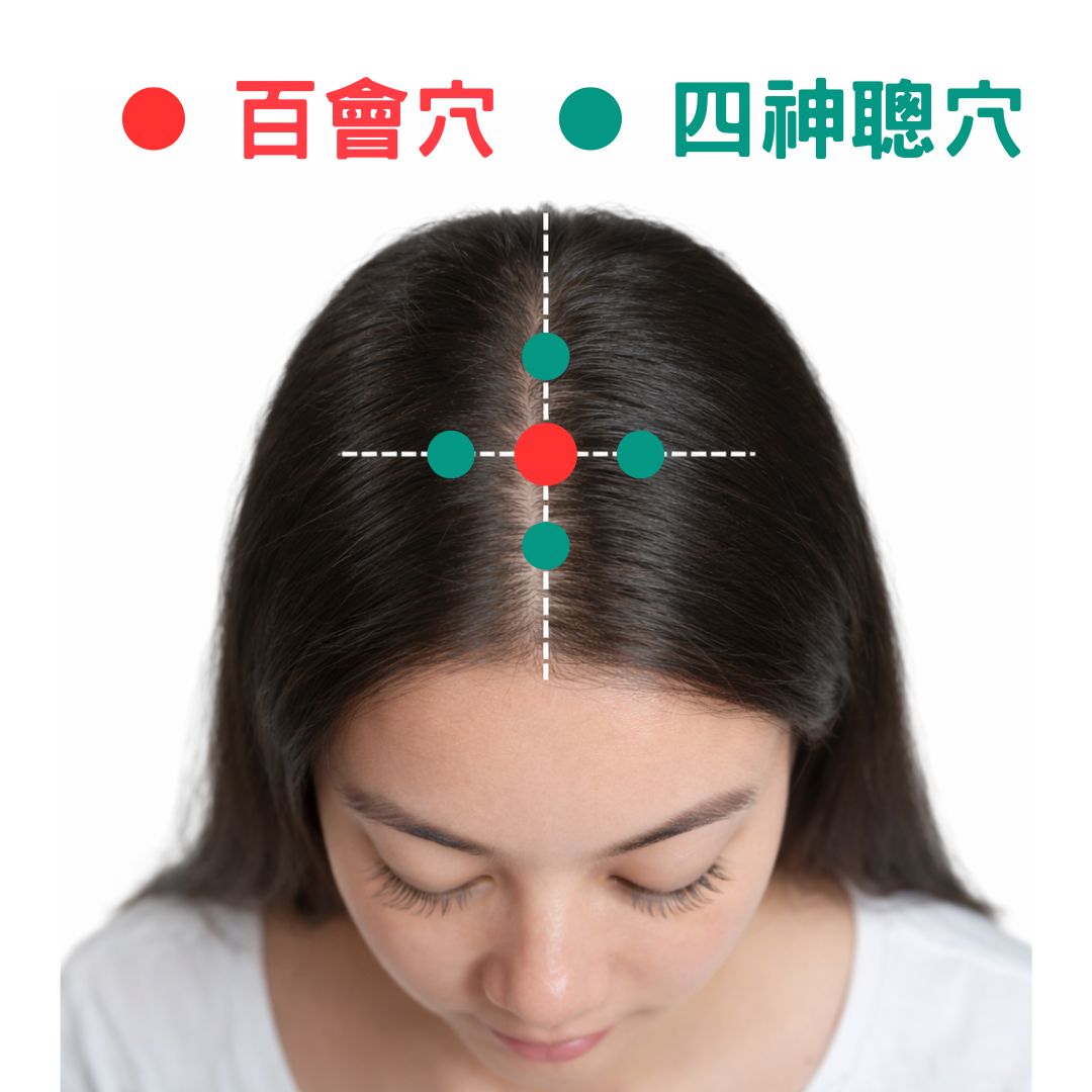 中年婦失眠7年難入睡轉中醫